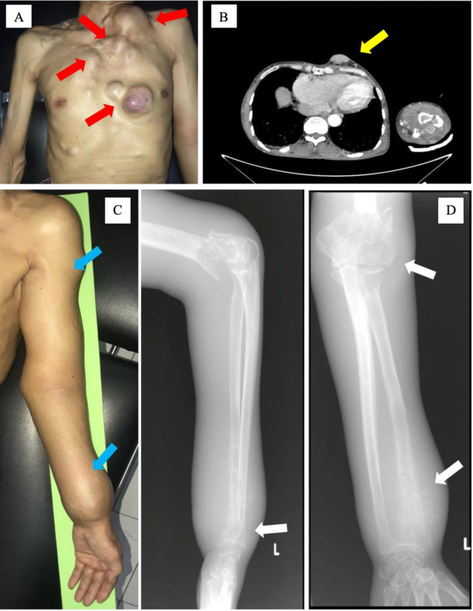 Fig. 1