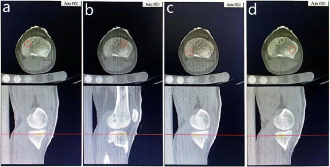 FIGURE 1