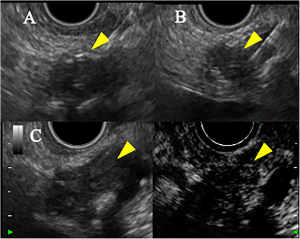 FIGURE 2