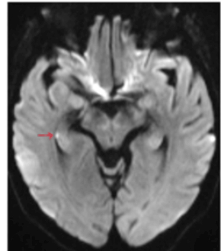 Figure 7