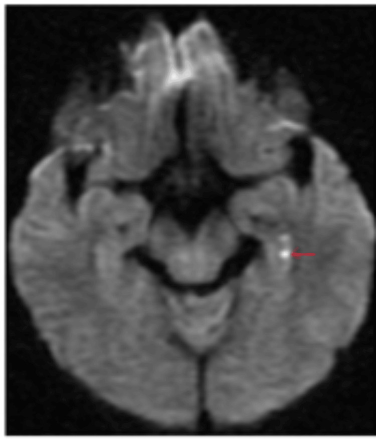 Figure 9