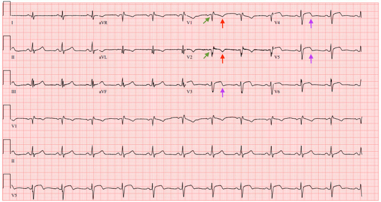 Figure 10