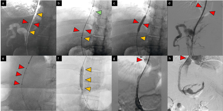 Figure 10
