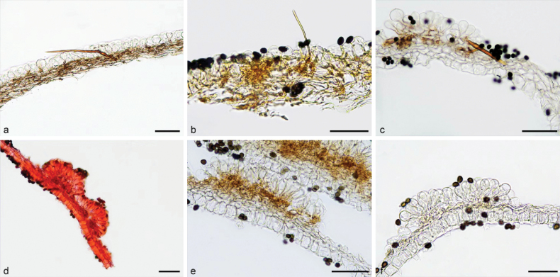Figure 22