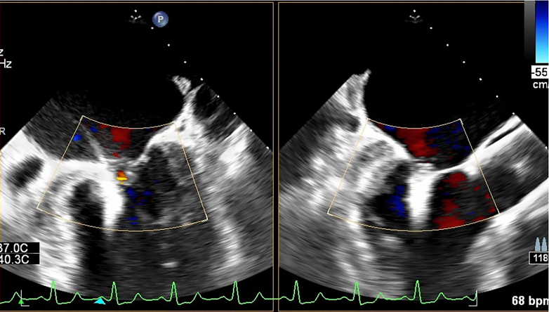 Figure 5