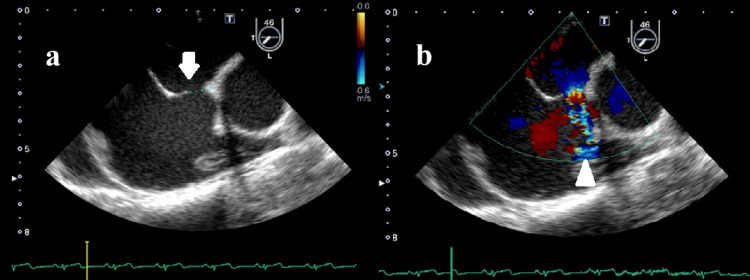Figure 5