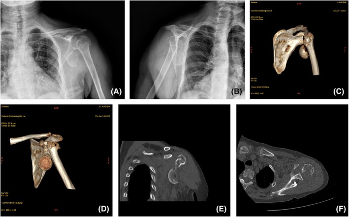FIGURE 1