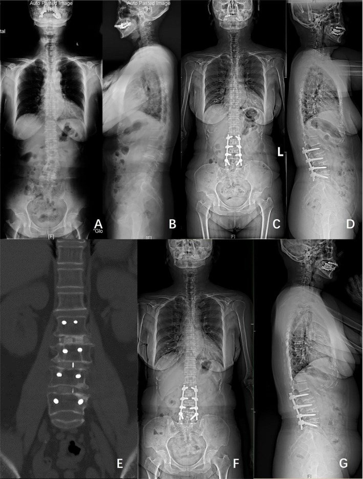 FIGURE 2