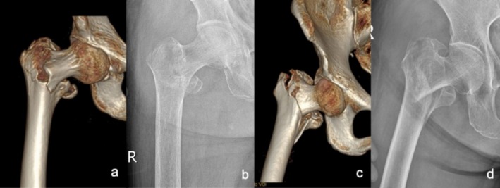 FIGURE 2