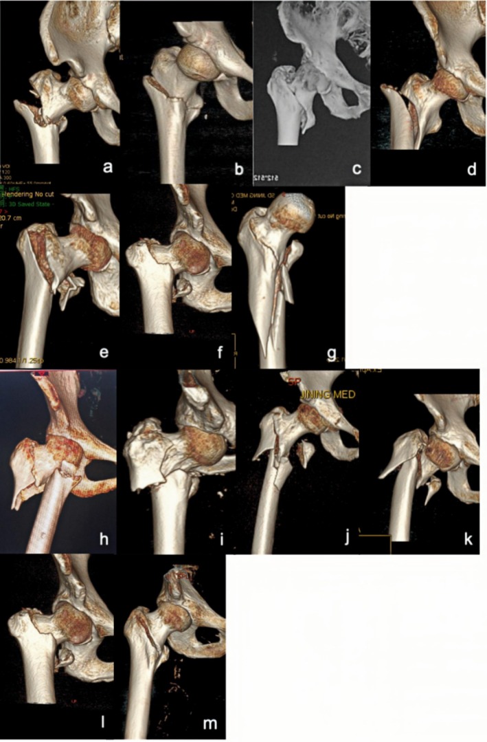 FIGURE 1