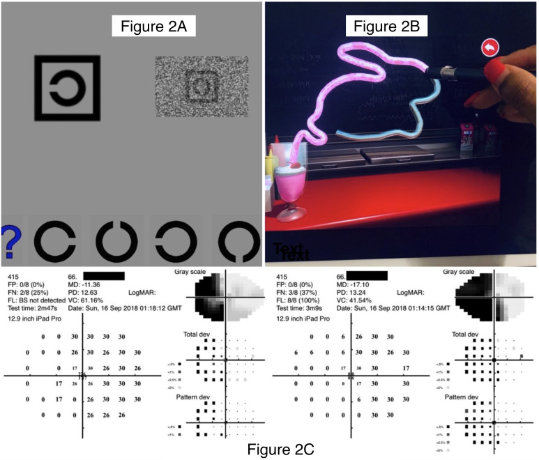 Figure 2