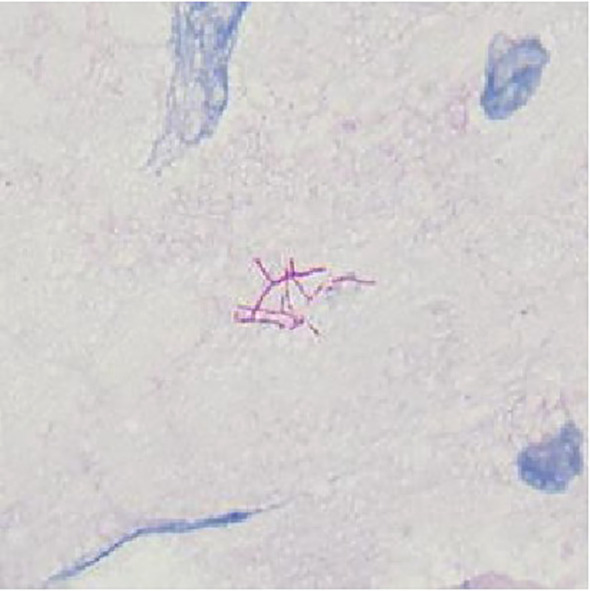 Figure 2