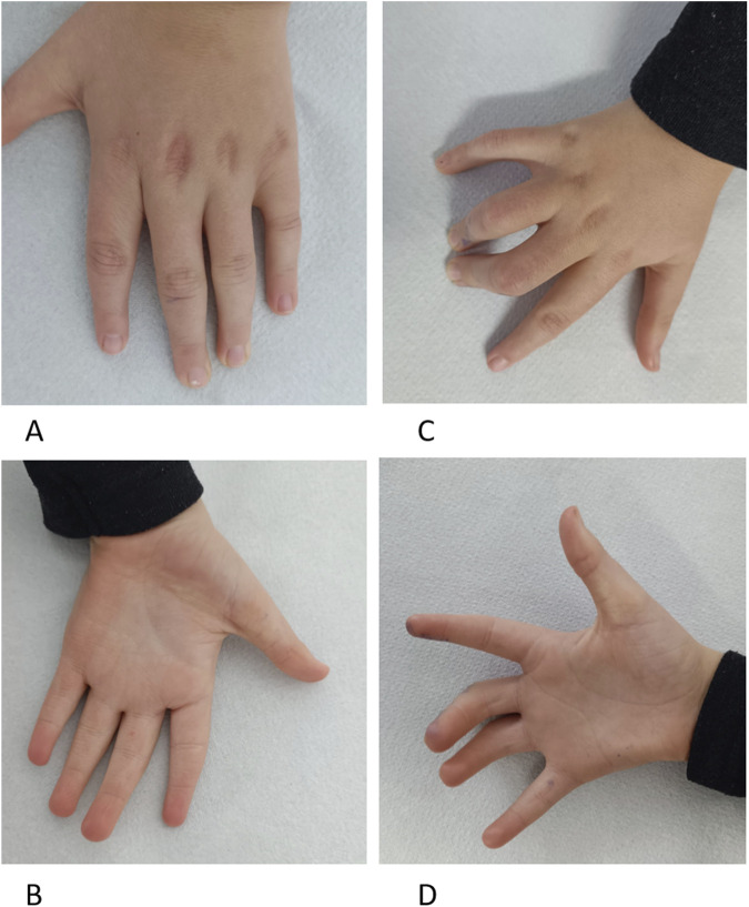 FIGURE 3