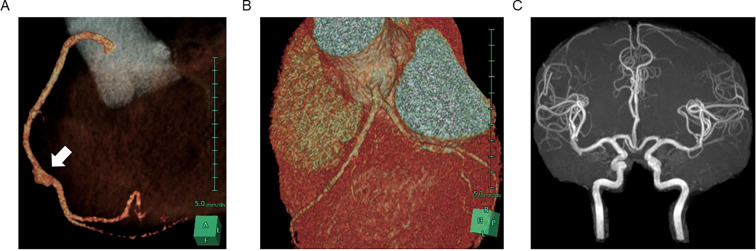 Figure 2