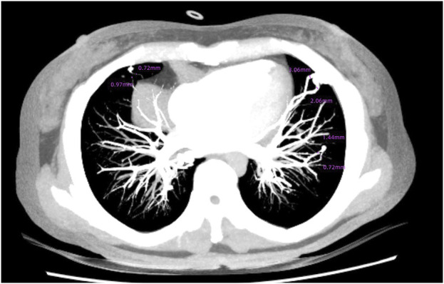 FIGURE 3