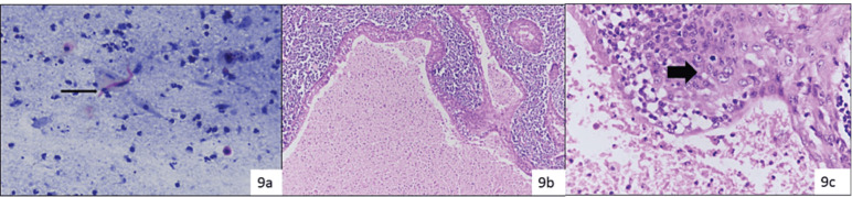 Figure 9