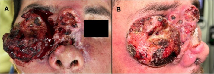 FIGURE 1