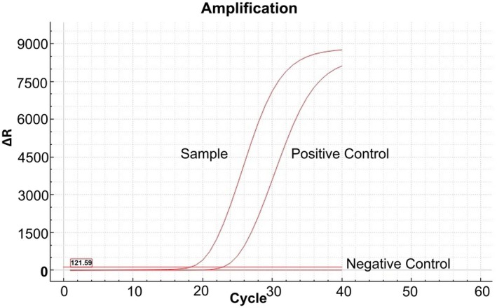 FIGURE 3