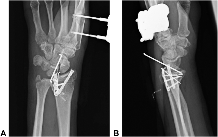 Figure 4