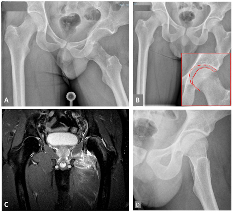 Figure 4