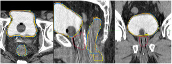 Figure 7