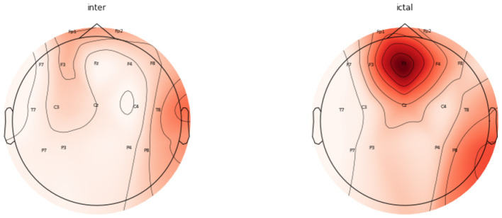 Figure 9