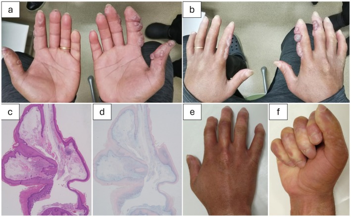 FIGURE 1