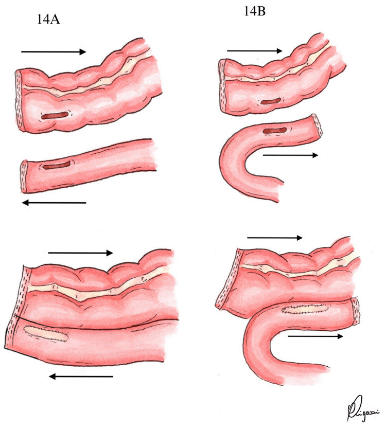 Figure 14