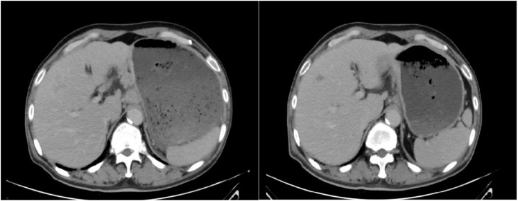 Figure 3
