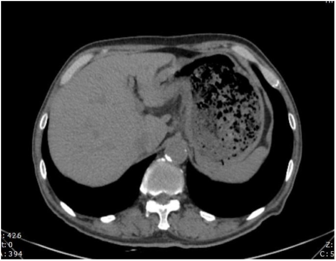 Figure 4