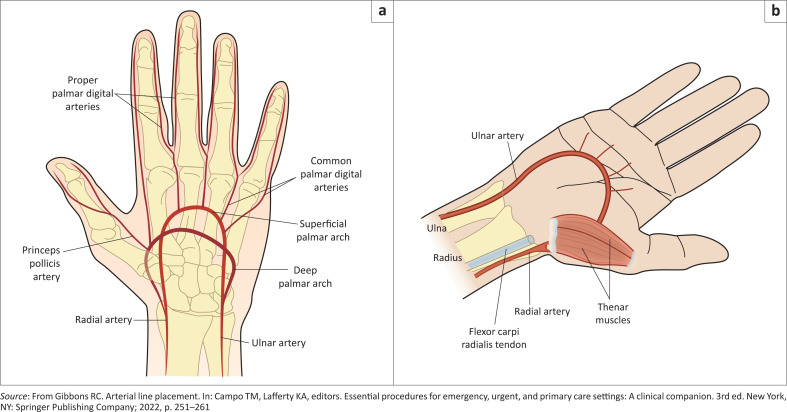FIGURE 1