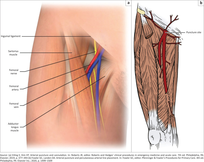 FIGURE 3
