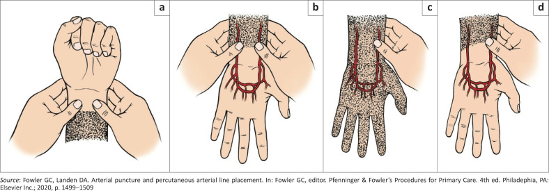 FIGURE 4
