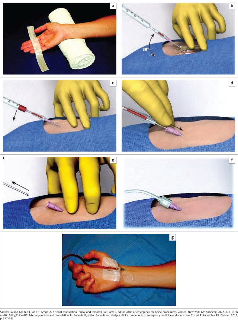 FIGURE 6