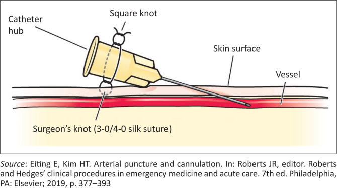 FIGURE 9