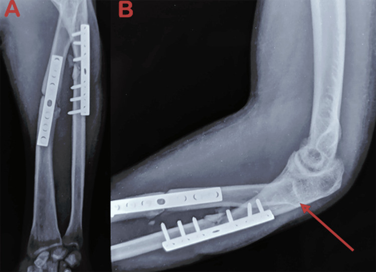 Figure 6