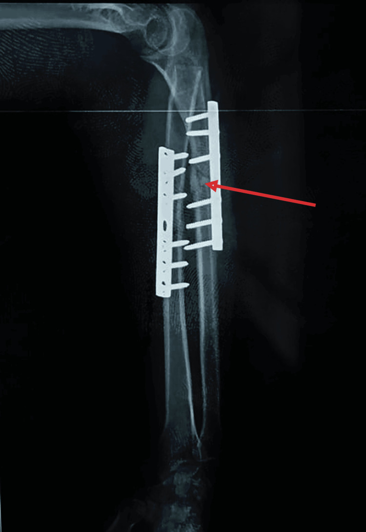 Figure 11