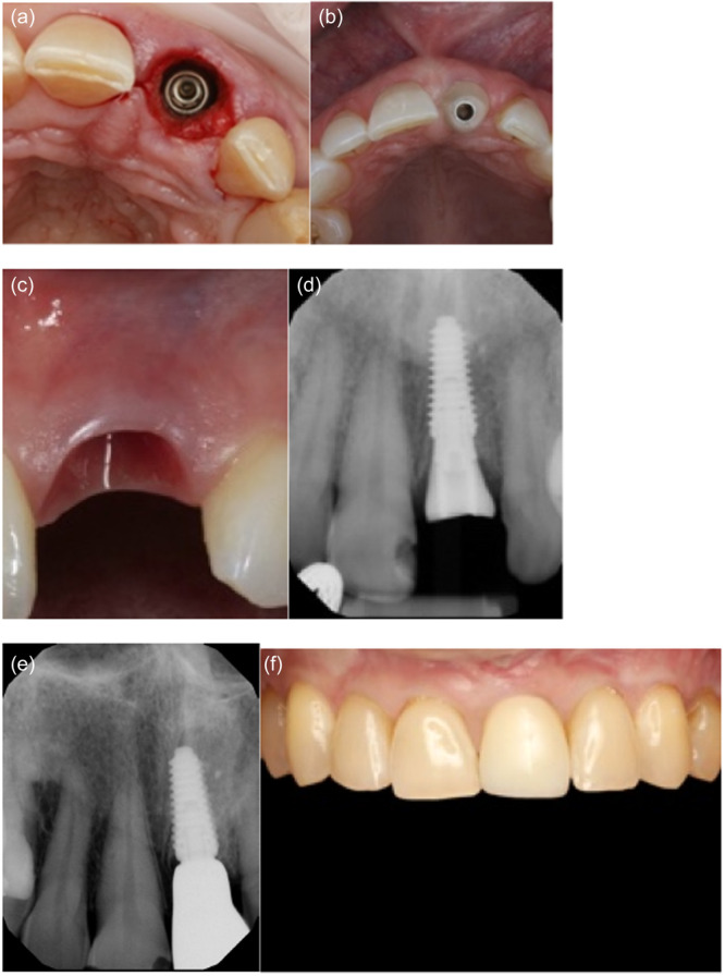 Figure 5
