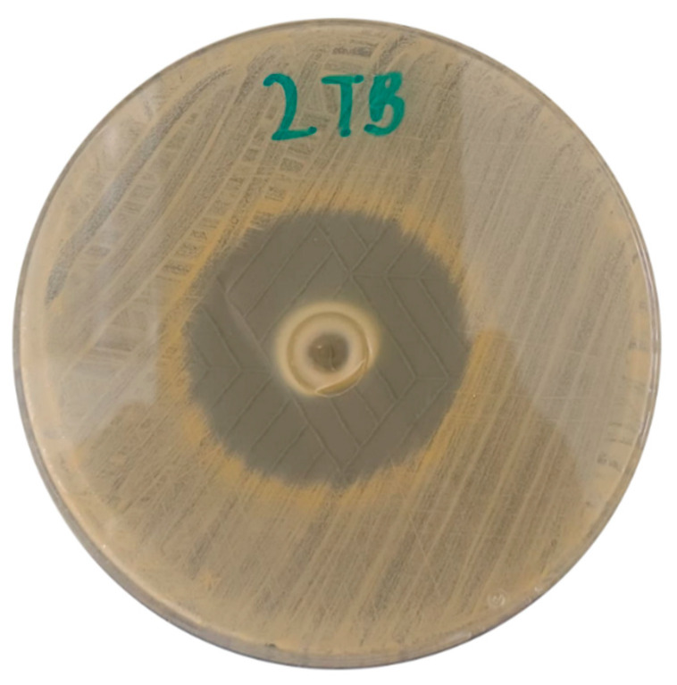 Figure 11