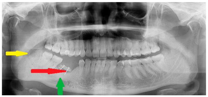 Figure 6