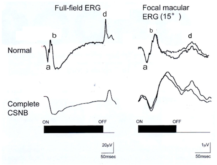 Figure 11