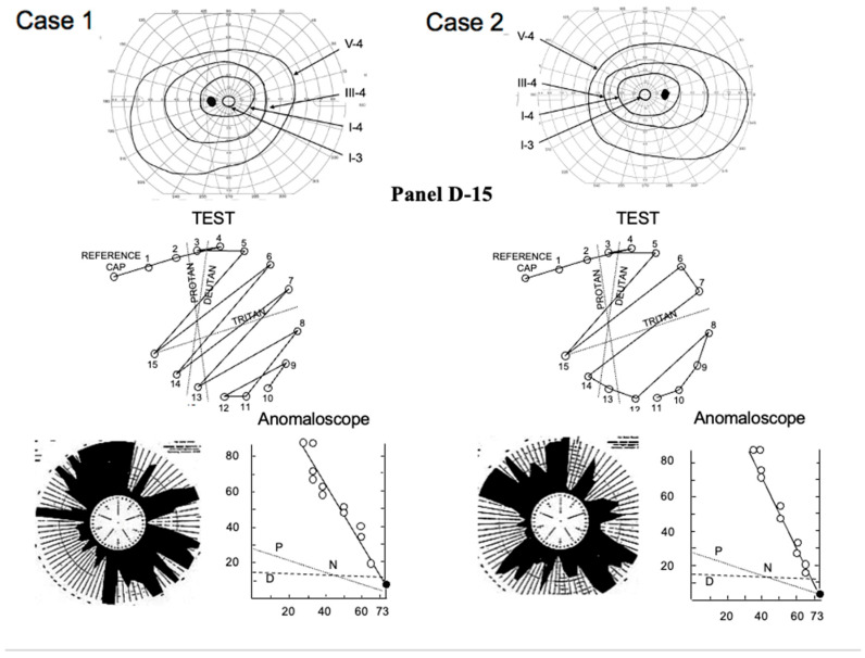 Figure 12