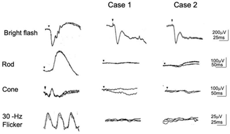 Figure 13