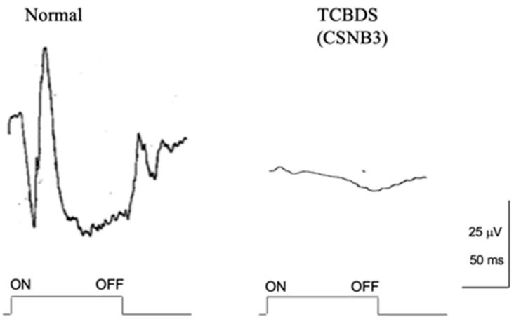 Figure 14