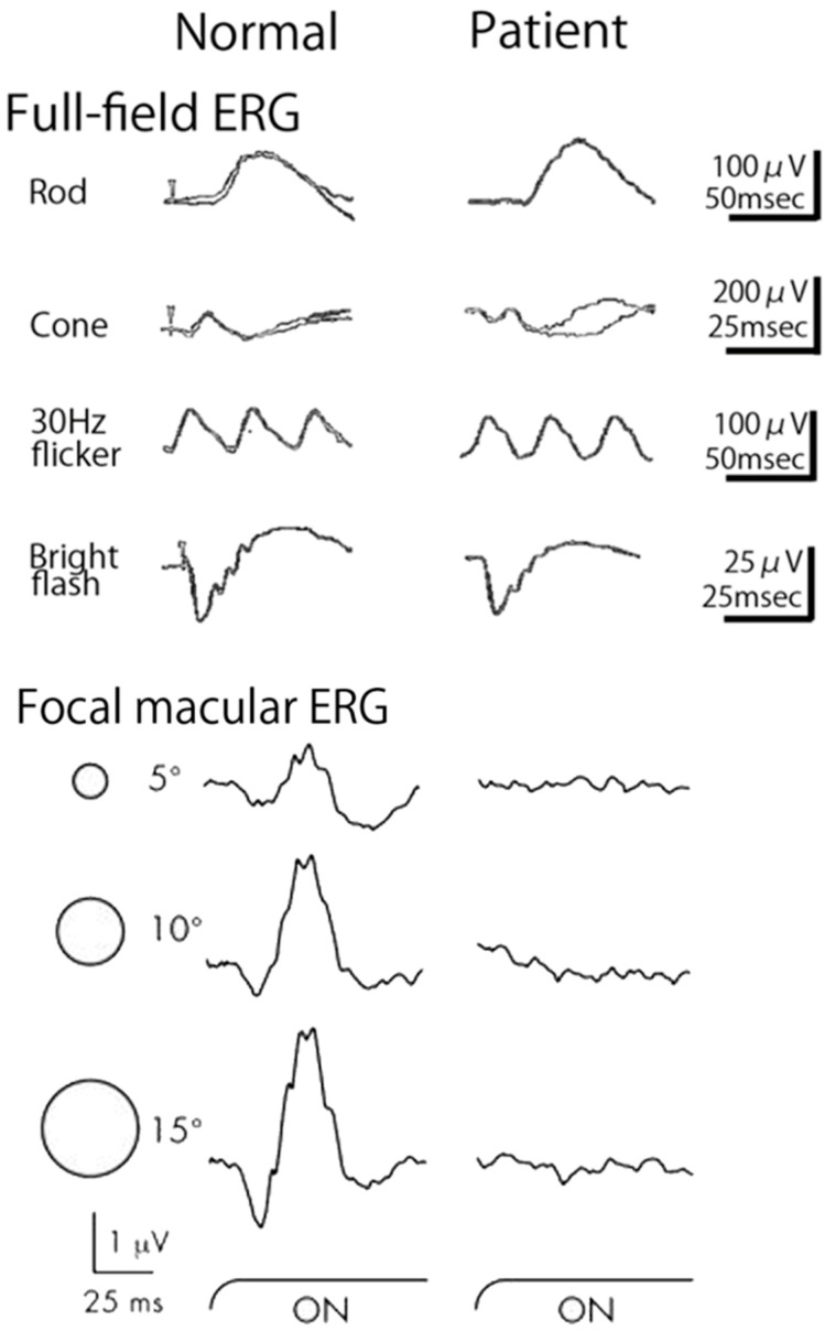 Figure 16