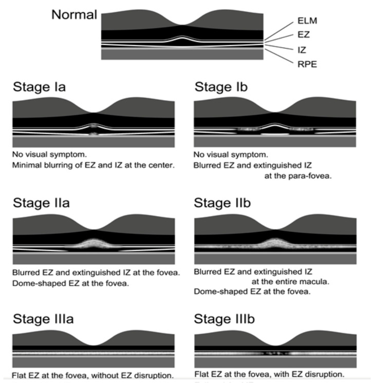 Figure 19