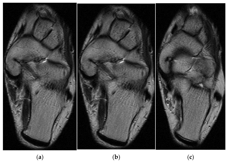 Figure 11