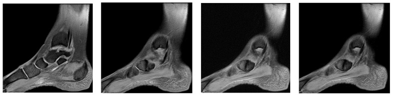 Figure 12