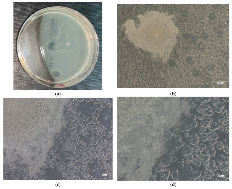 Figure 11