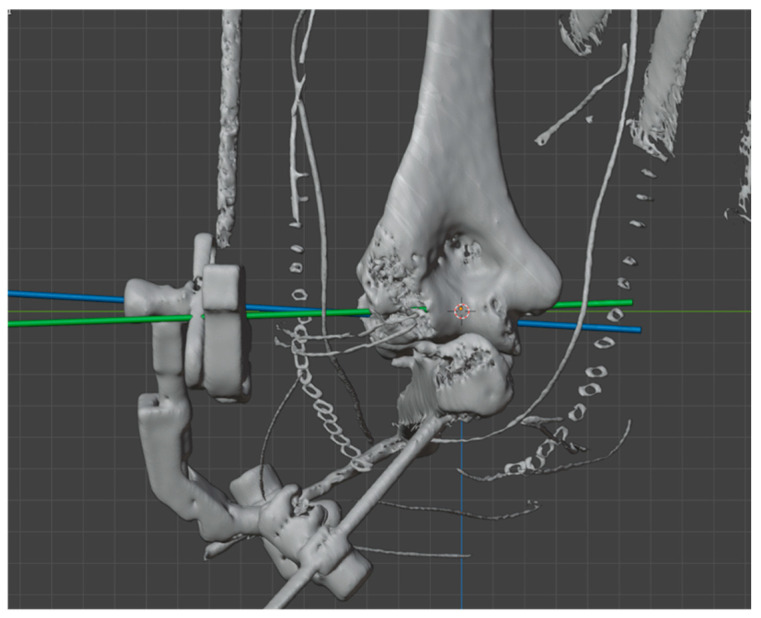 Figure 5